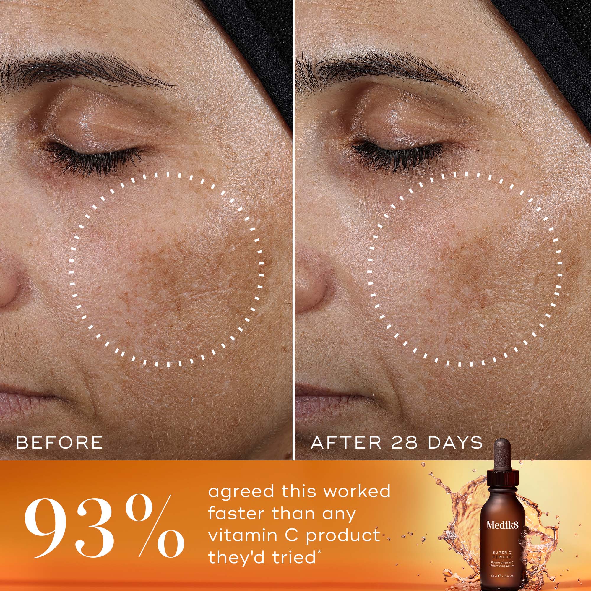 PDP Asset 3 -Super C Ferulic - B&A - ROW